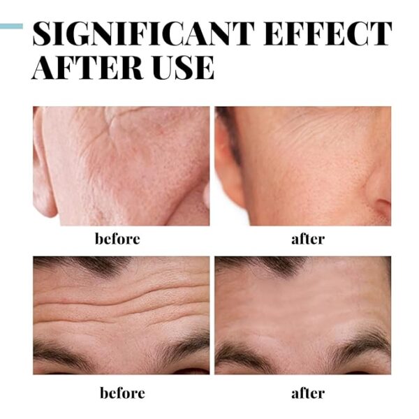 EELHOE Collagen Men's Anti-Aging Wrinkle Cream - Image 4
